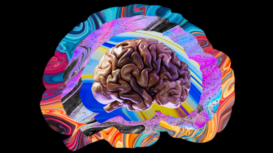 brain strat img uai
